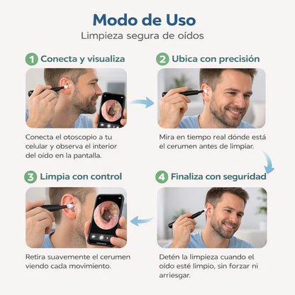 EarlyPro™ — Otoscopio Digital con Cámara HD para Oídos